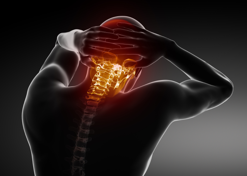 neck pain Complete Wellness Physio