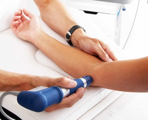 Radial Shockwave Therapy